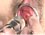 Other - 
